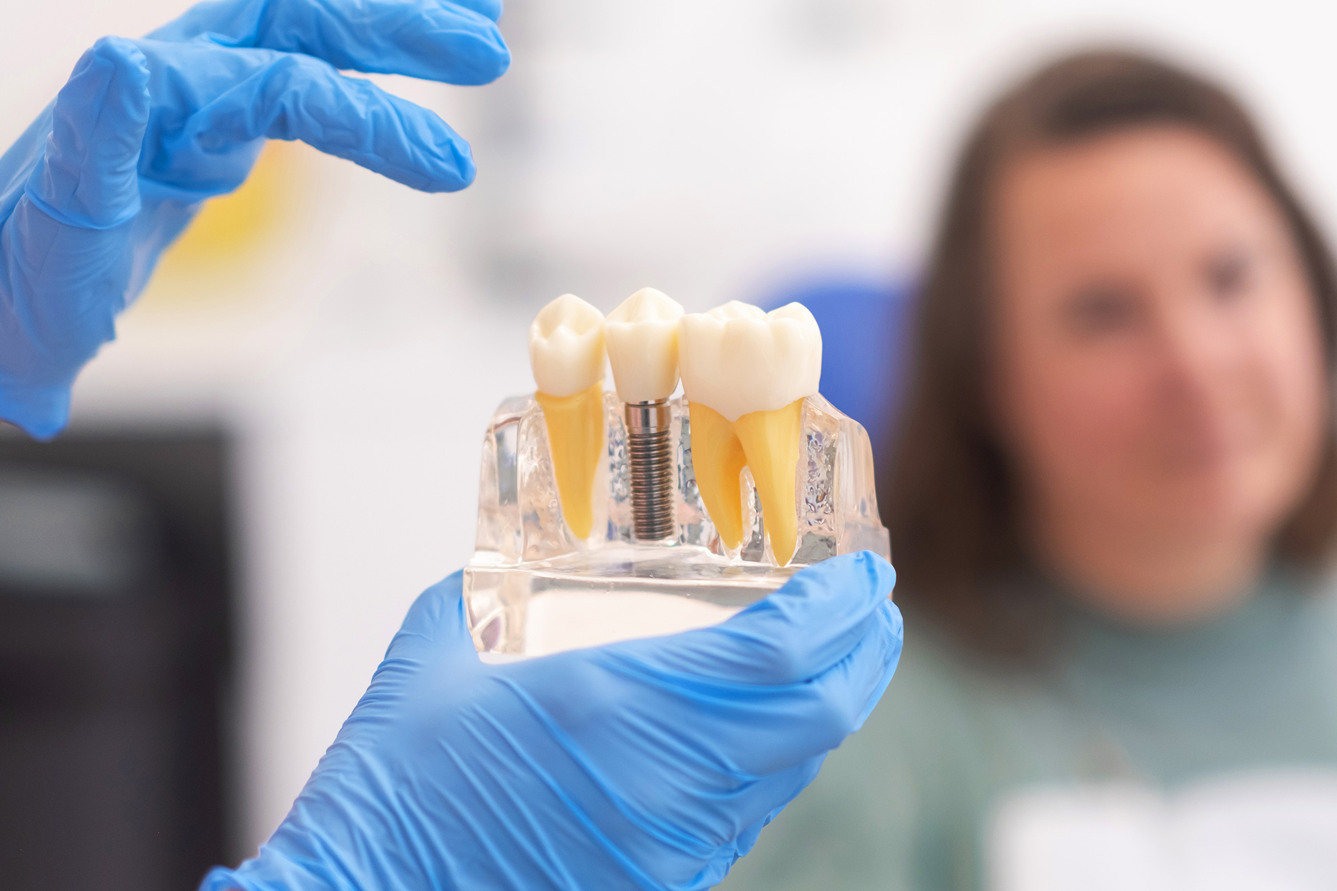 Dental Implants & Tooth Replacement