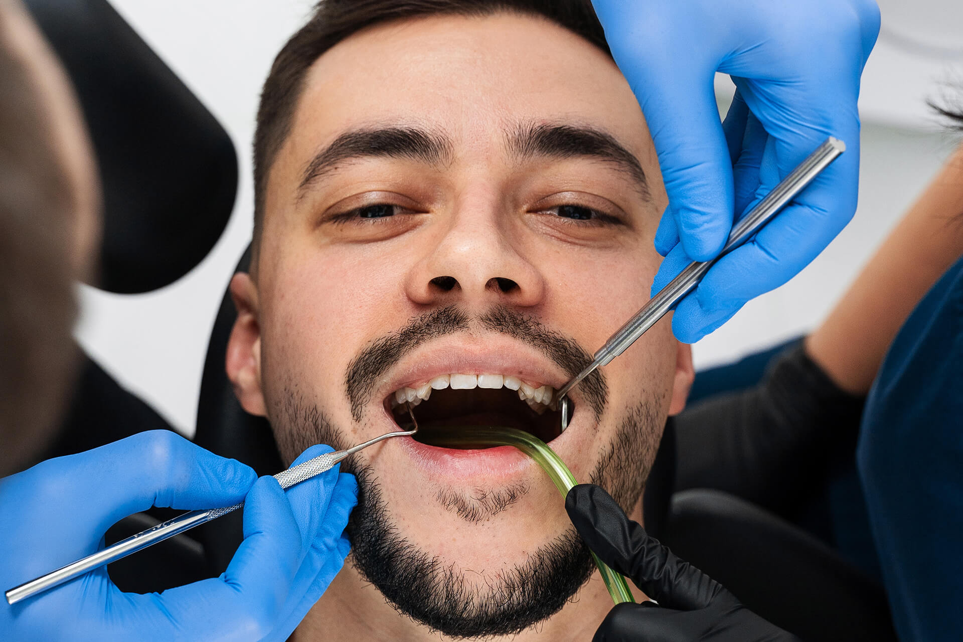 Endodontics (Root Canal Treatment)